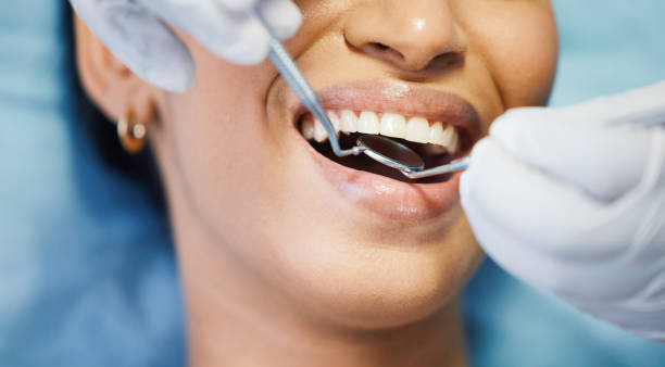 Best Urgent Care for Lost Fillings or Crowns in Lake Elsinore, CA